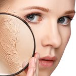 Mujer con piel seca